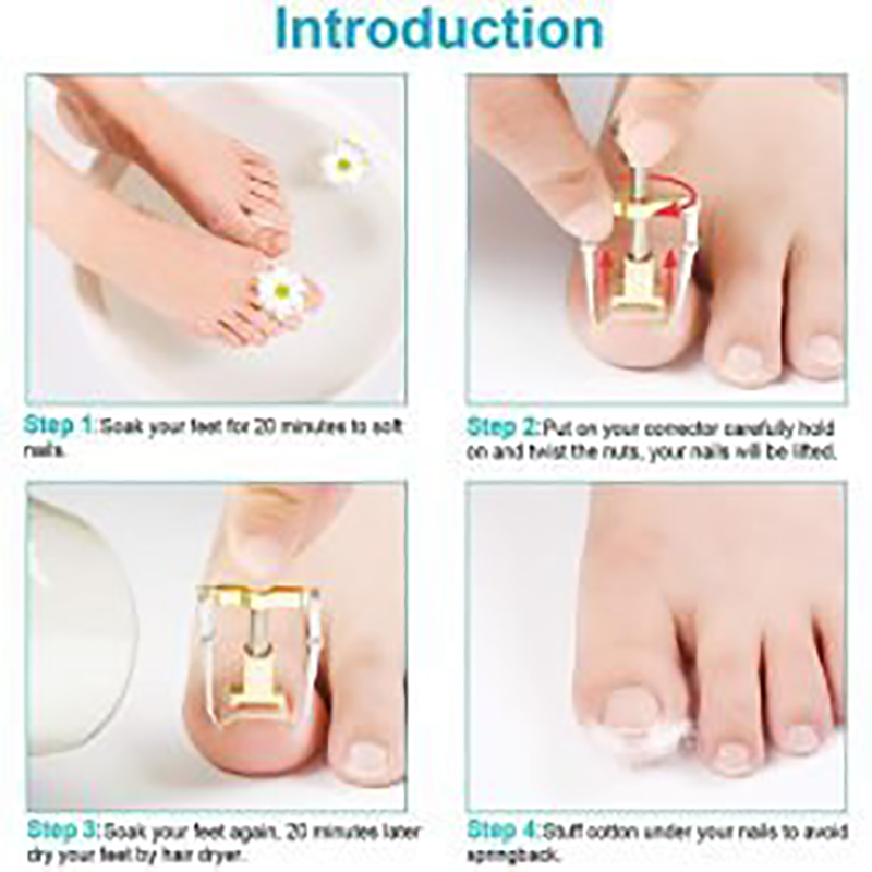 دستگاه اصلاح فرم و ارتودنسی ناخن